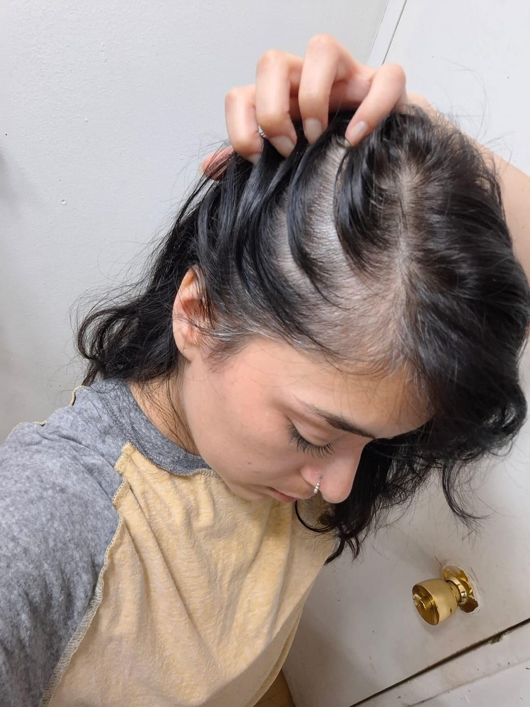 Customer photo review of Pack Anticaída de Cabello para 1 Mes