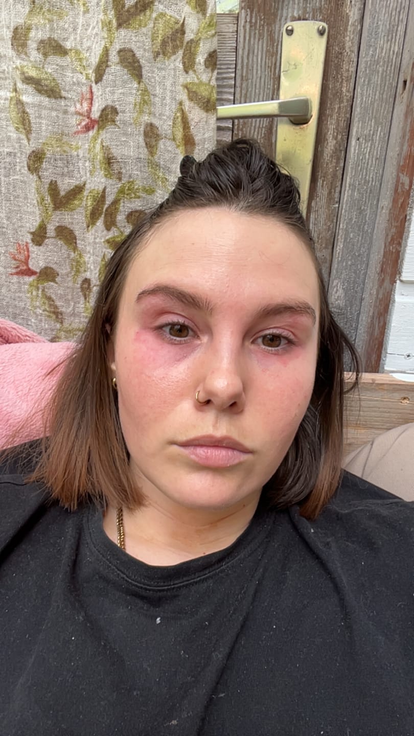 Customer photo review of BROWCOCA!NE - Augenbrauenserum