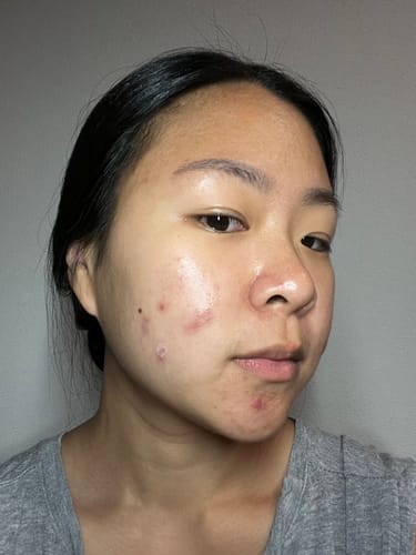 Customer photo review of Skin Formula