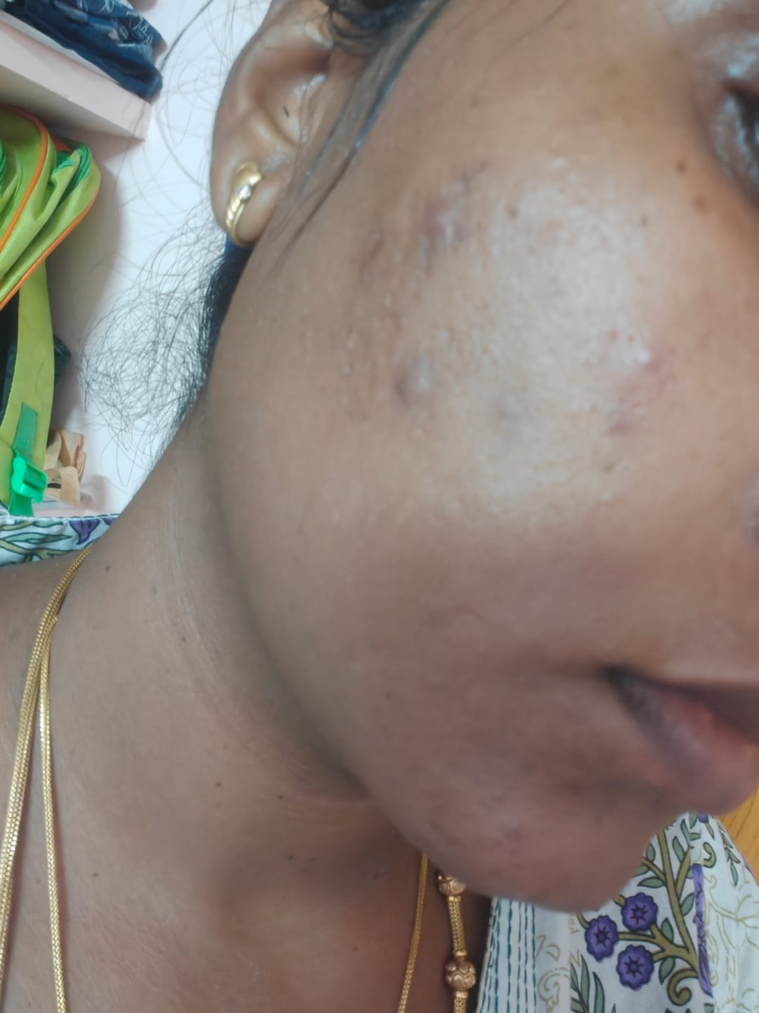 Customer photo review of Turmeric Night Repair Cream