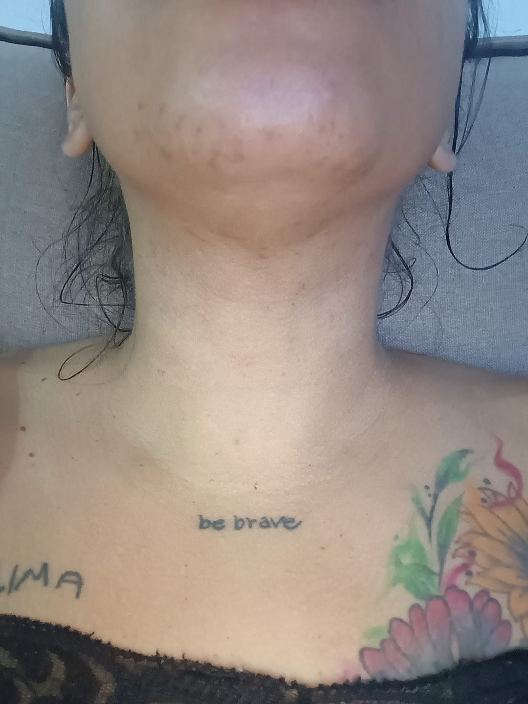 Customer photo review of Kit Clareamento Total + 1 Firmador de Brinde