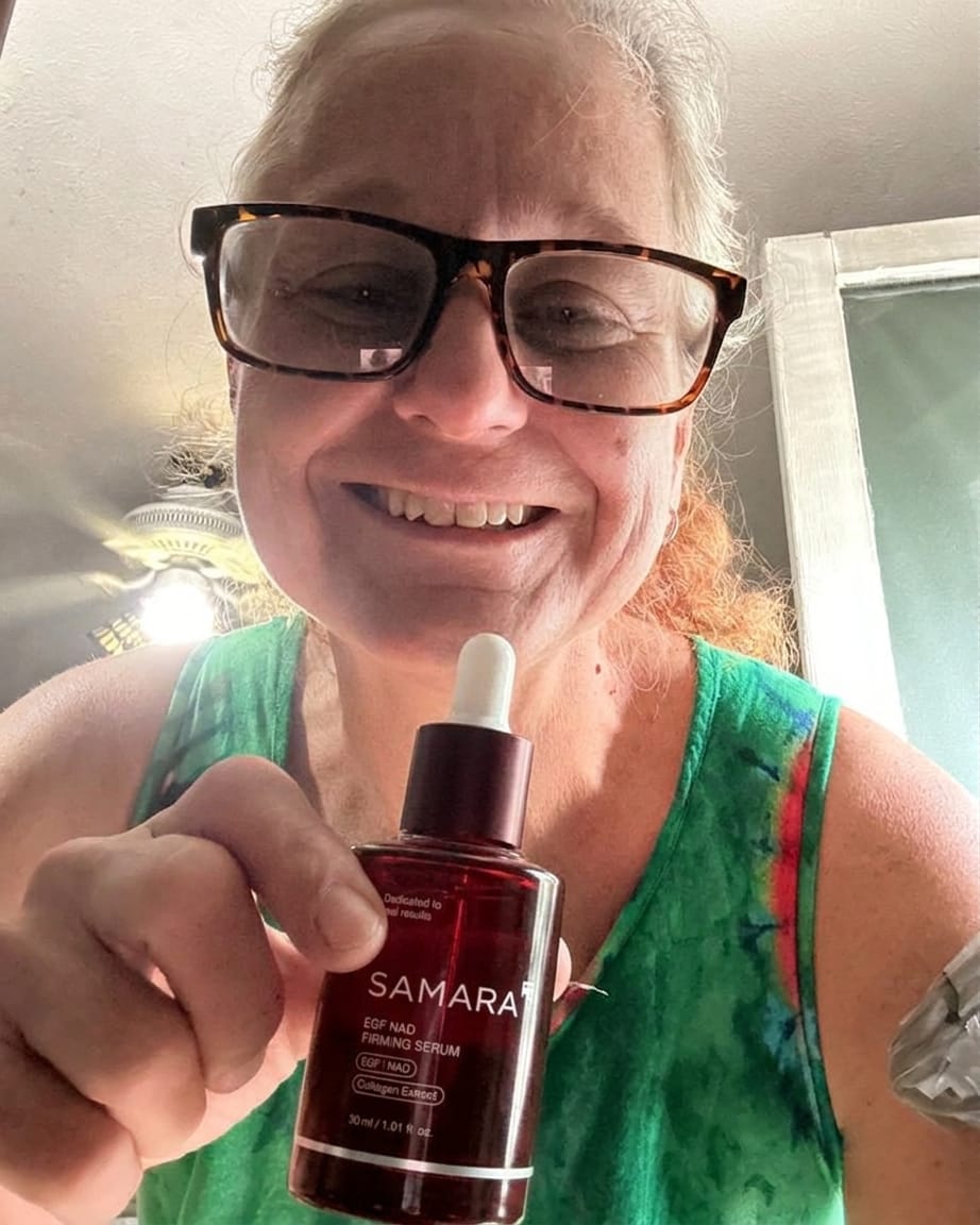 Customer photo review of NAD SERUM