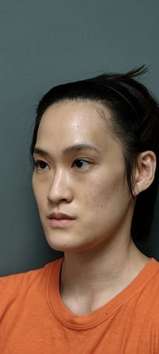 Customer photo review of Skin Formula