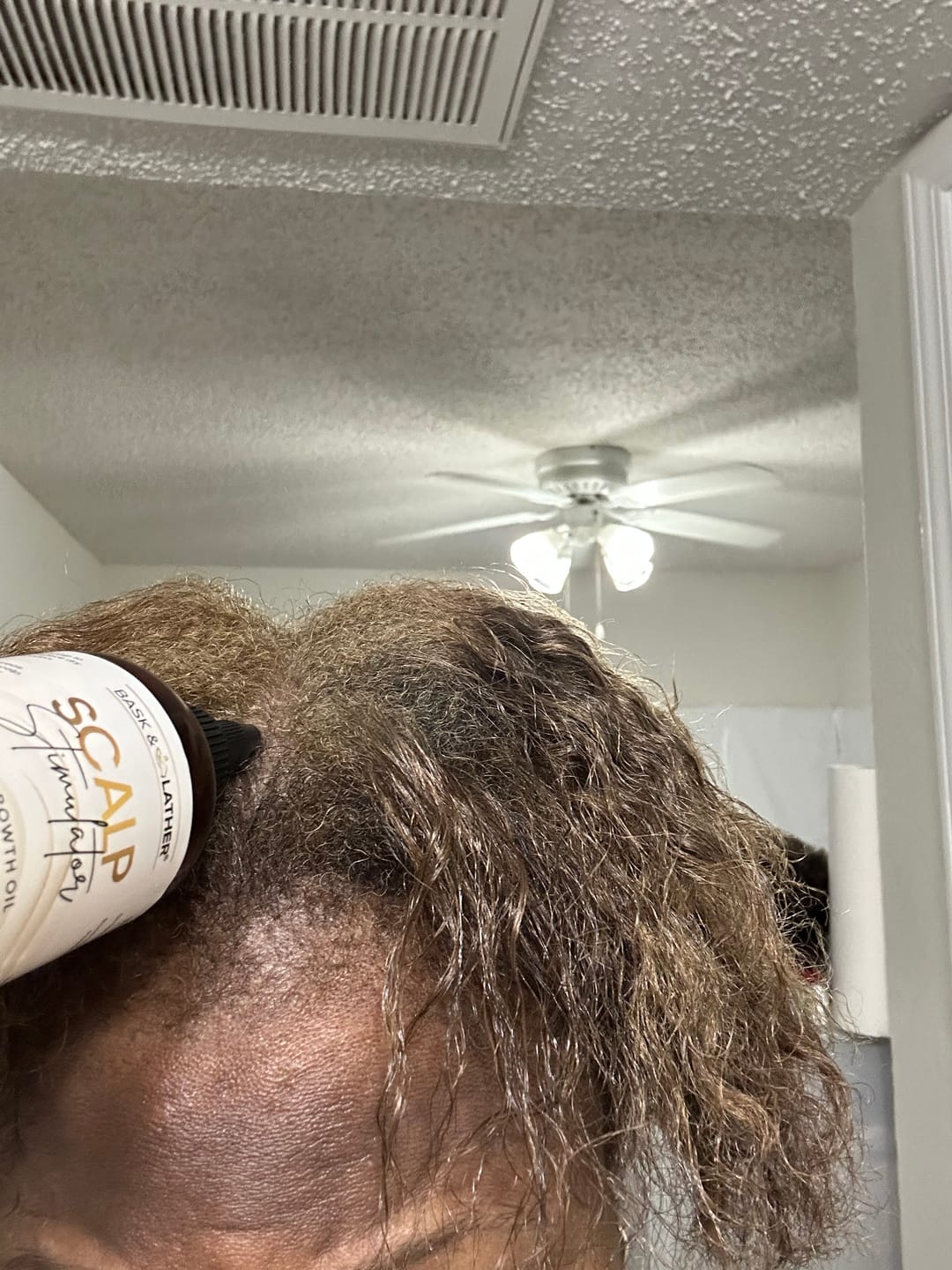 Customer photo review of Scalp Therapy System