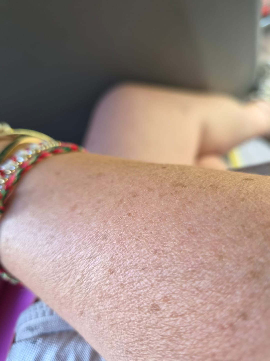 Customer photo review of Good Sun Auto-bronzant - 1 mois
