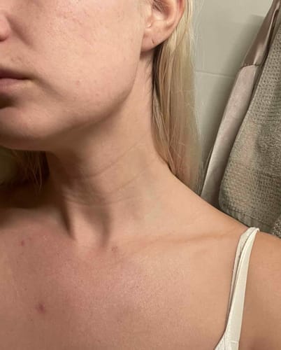 Customer photo review of Skin Formula