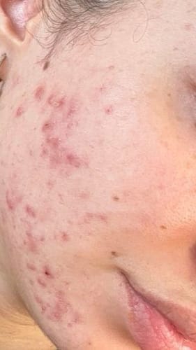 Customer photo review of Skin Formula