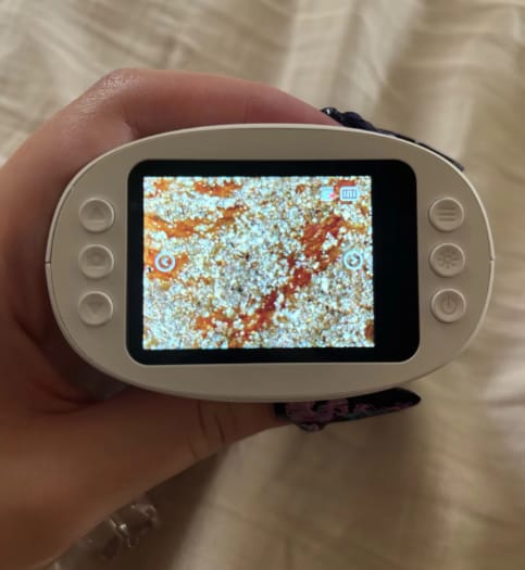Customer photo review of HD子どもスコープ