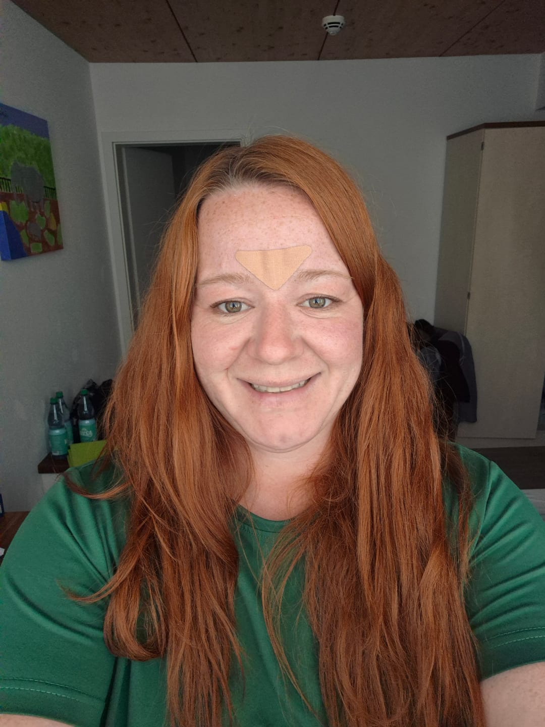 Customer photo review of Zornesfalten Patches mit Hyaluron