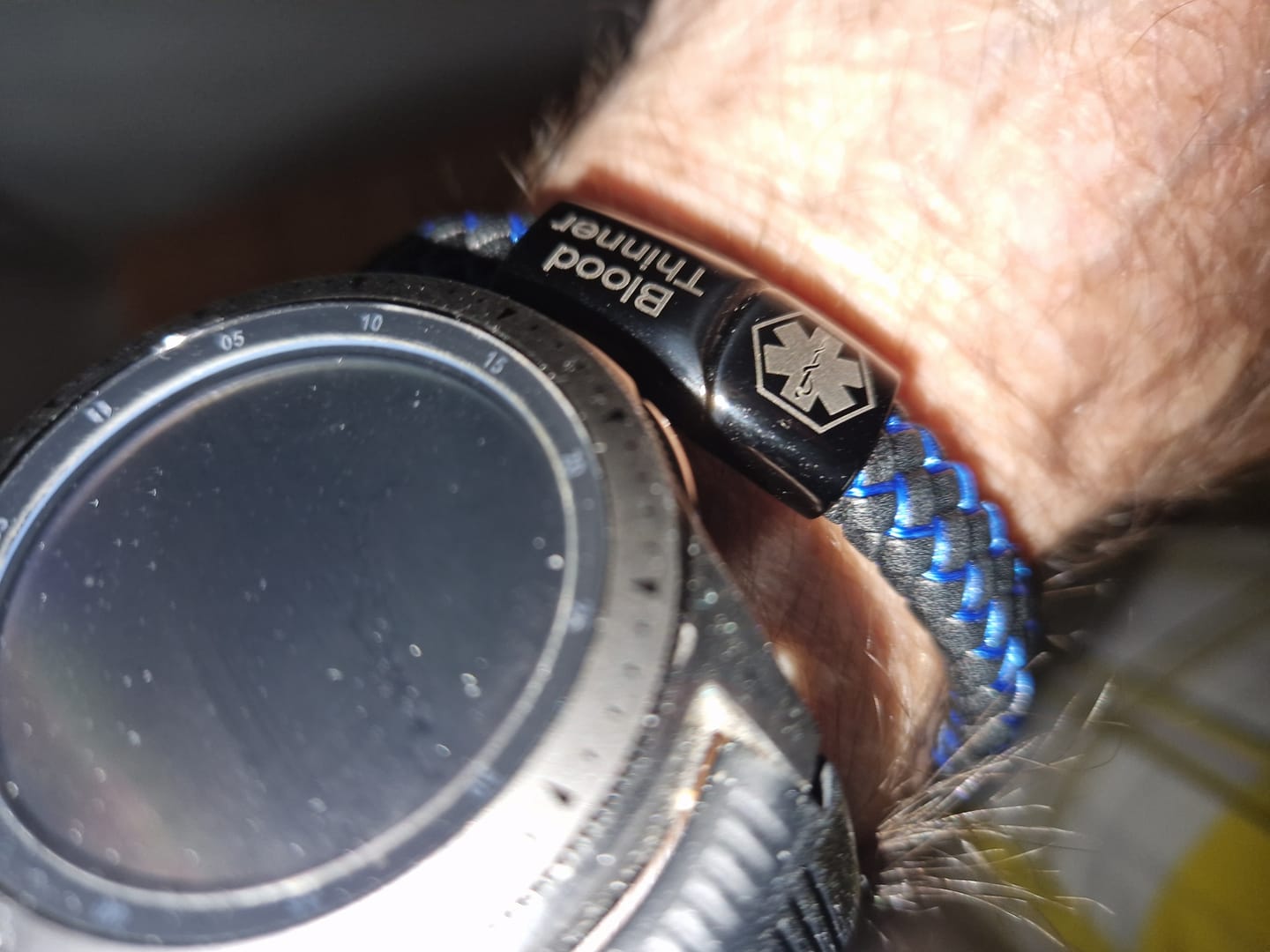 Customer photo review of Medizinisches Notfallarmband