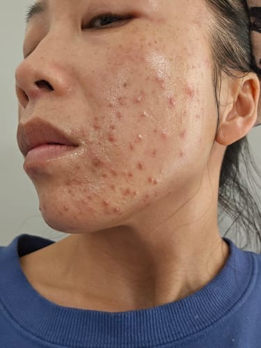 Customer photo review of Skin Formula