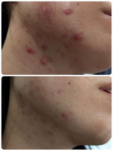 Customer photo review of Skin Formula