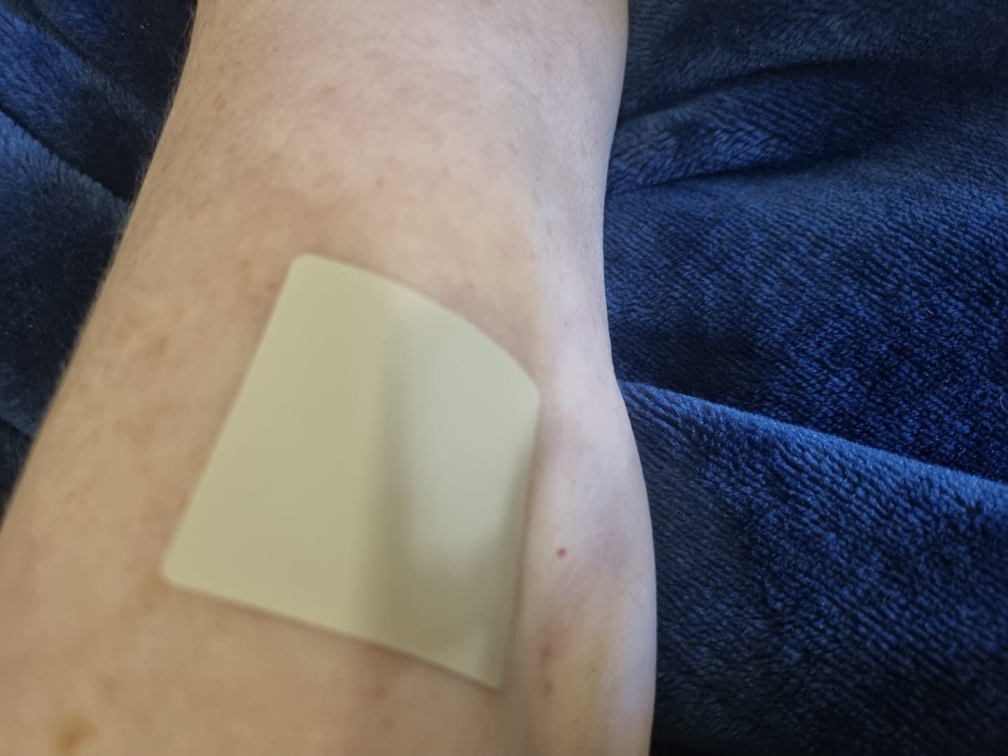 Customer photo review of mussage 8 Hour Sleep Patch