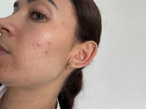 Customer photo review of Skin Formula