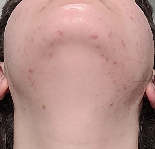 Customer photo review of Skin Formula