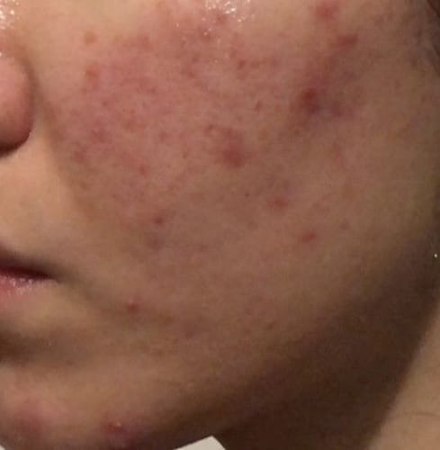 Customer photo review of Skin Formula
