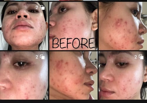 Customer photo review of Skin Formula