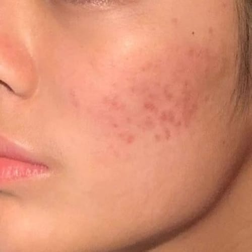 Customer photo review of Skin Formula