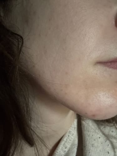 Customer photo review of Skin Formula