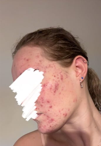 Customer photo review of Skin Formula