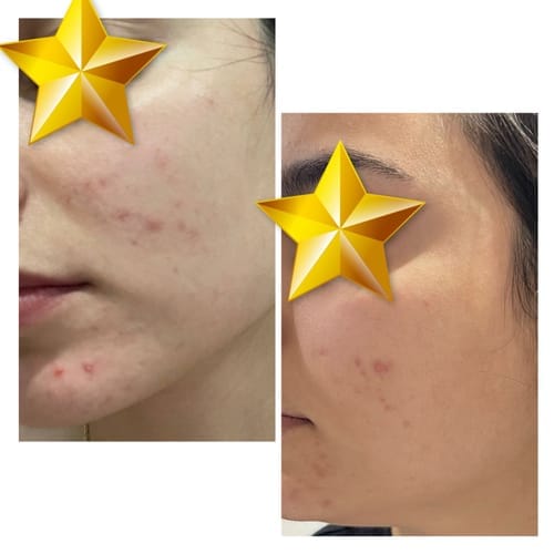 Customer photo review of Skin Formula
