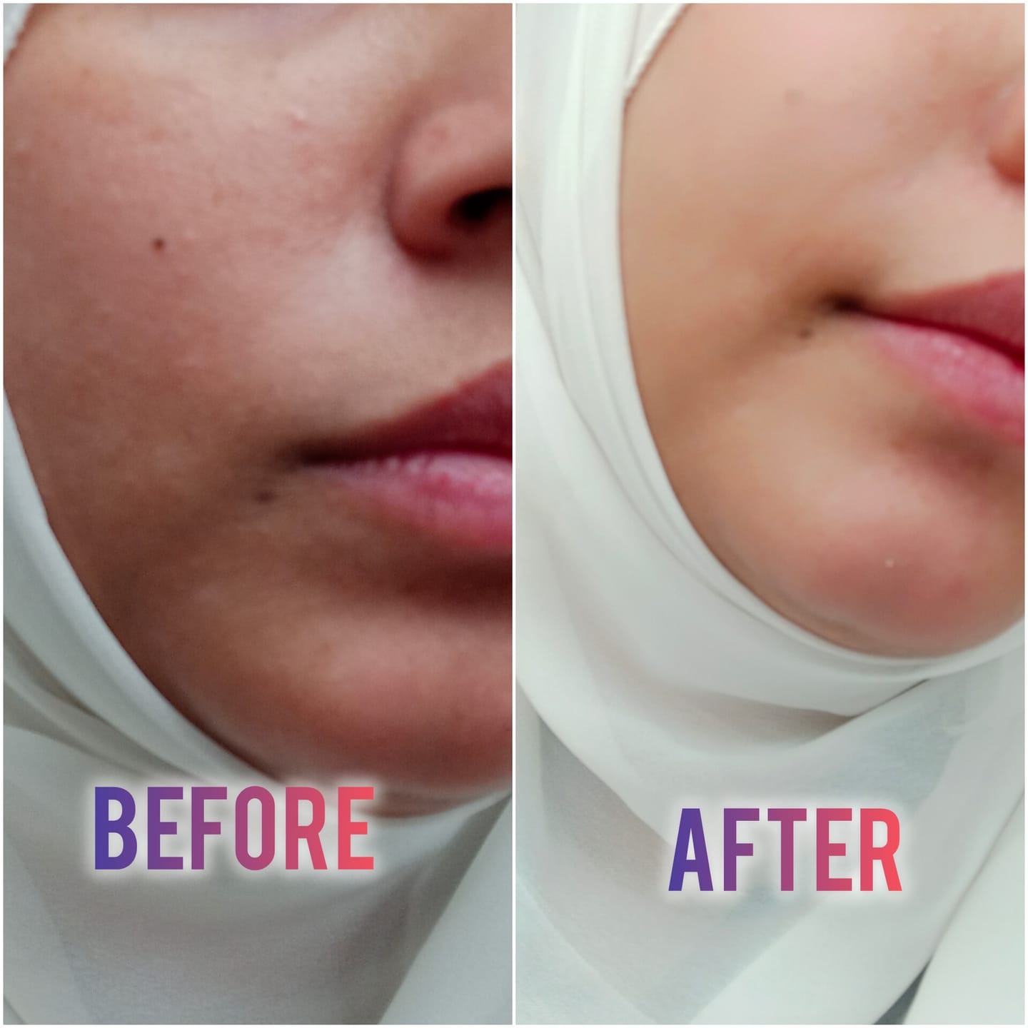 Customer photo review of Maxdif Brightening Cream