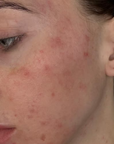 Customer photo review of Skin Formula