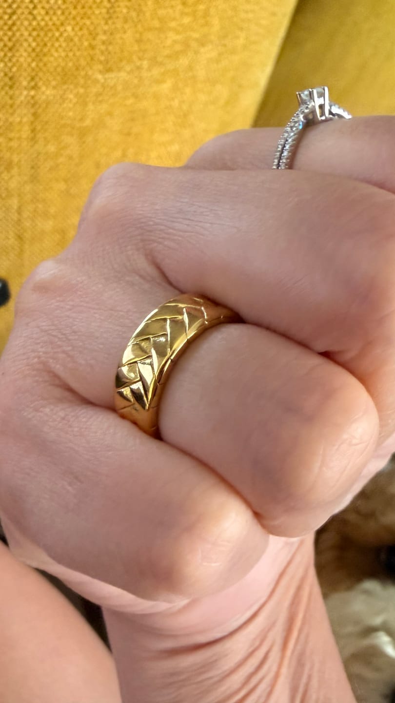 Customer photo review of Banig Ring