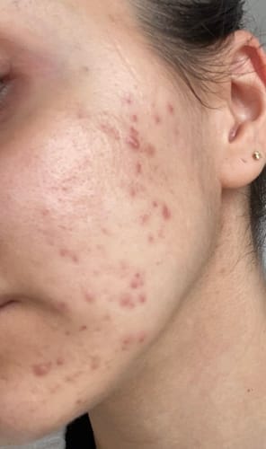 Customer photo review of Skin Formula