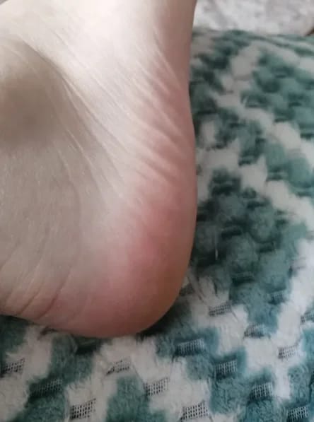 Customer photo review of SOVA Glide™