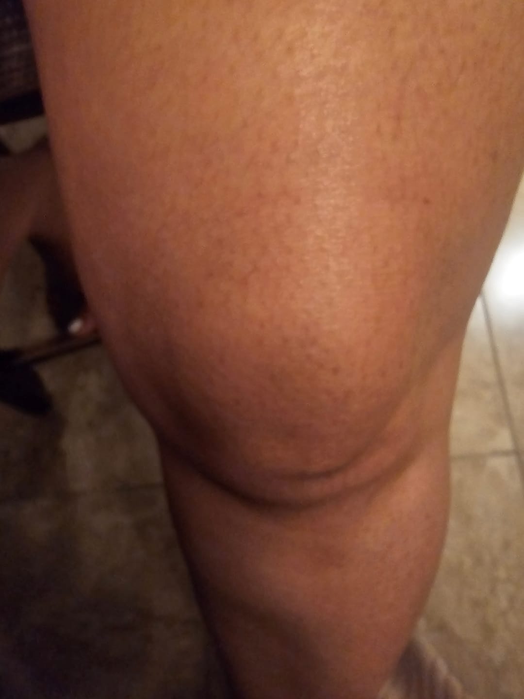 Customer photo review of Turmeric and Kojic Foaming Face Wash