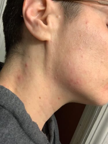 Customer photo review of Skin Formula