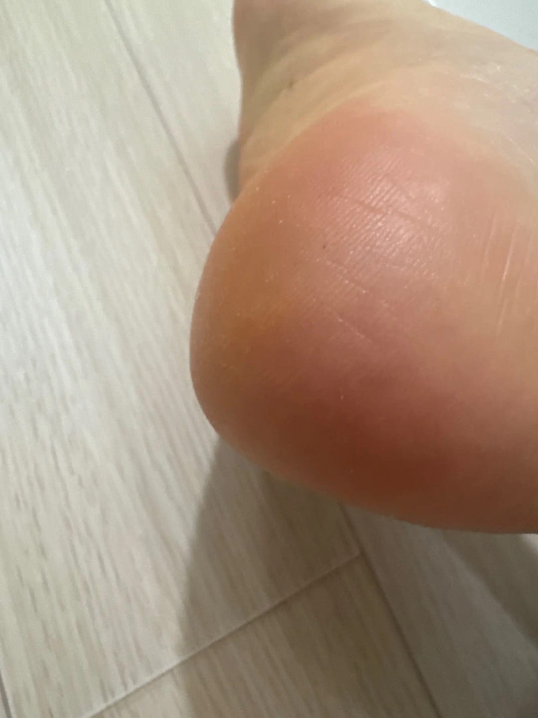 Customer photo review of SOVA Glide™