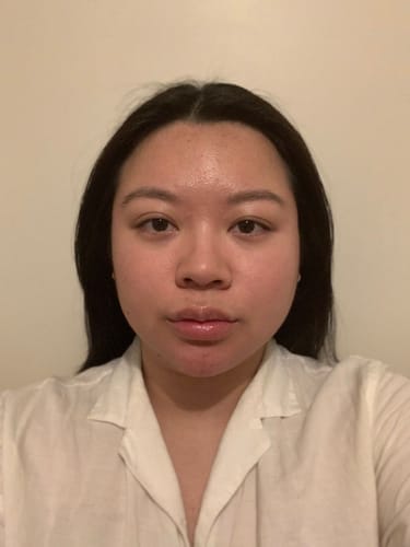 Customer photo review of Skin Formula