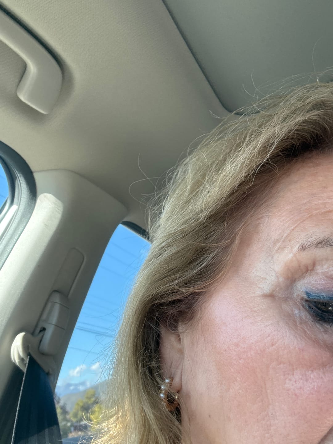 Customer photo review of Set 6 Serum Activador