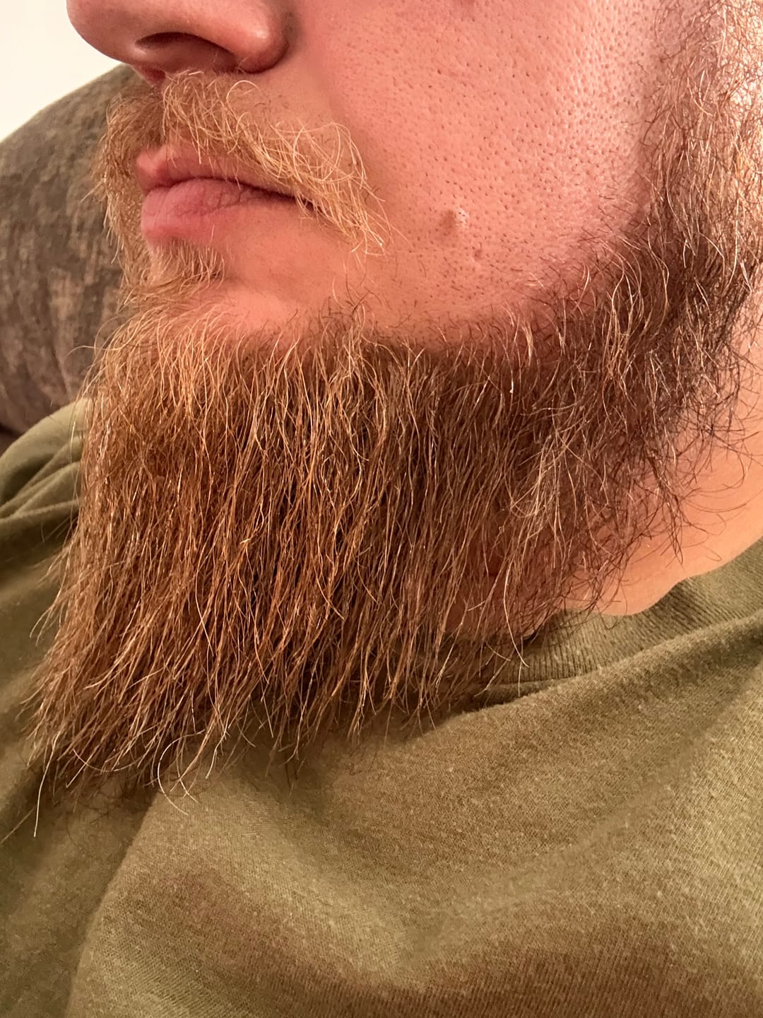 Customer photo review of Moisturizer For Hair, Skin, & Beard