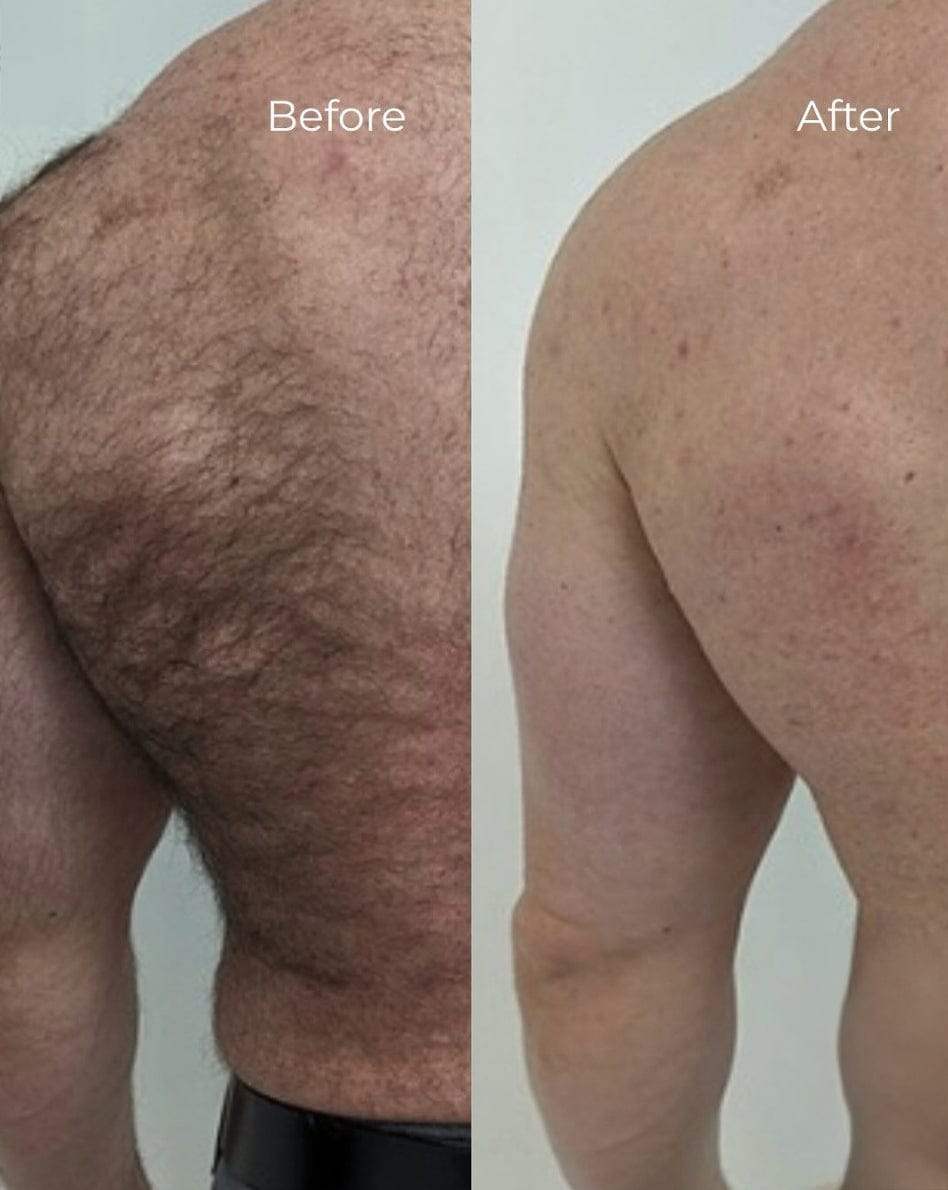 Customer photo review of Dermave™ Electric Trimmer 2.0 for Men