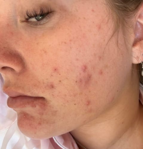 Customer photo review of Skin Formula