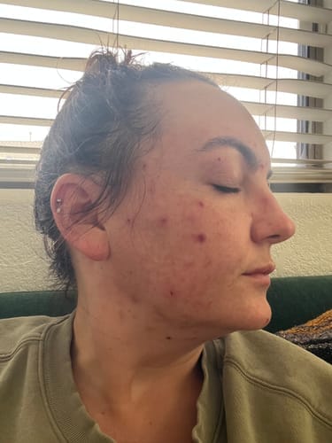 Customer photo review of Skin Formula
