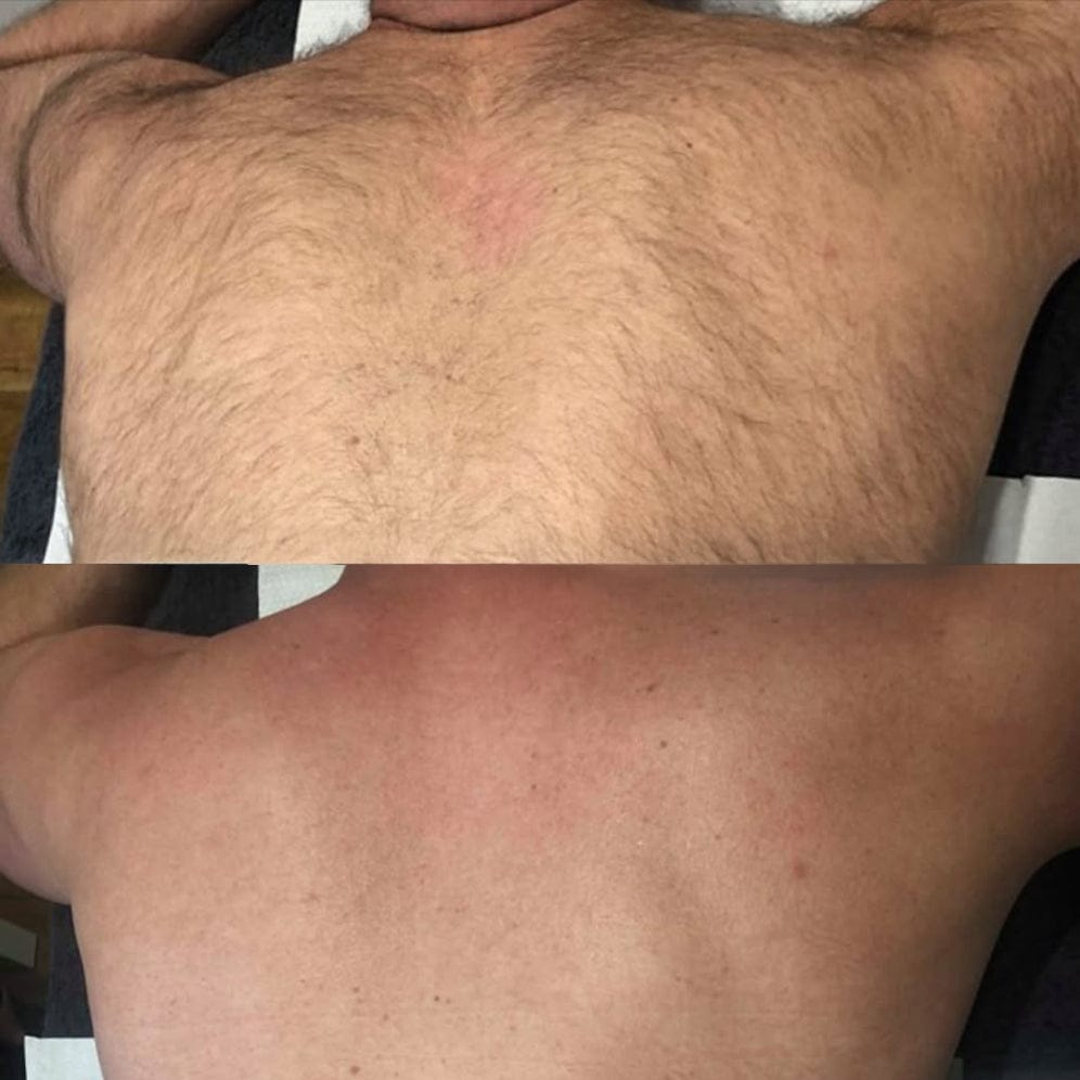 Customer photo review of Dermave™ Electric Trimmer 2.0 for Men