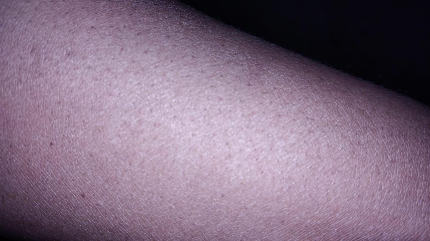 Customer photo review of LightenUp Plus Brightening Body Lotion