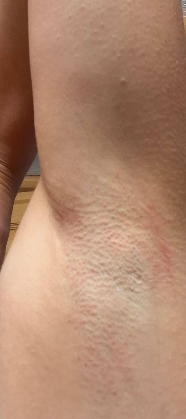 Customer photo review of Zoua Glide | Gentle on Skin. Tough on Hair.