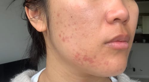 Customer photo review of Skin Formula