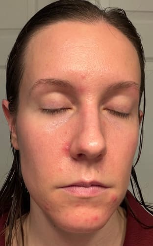 Customer photo review of Skin Formula