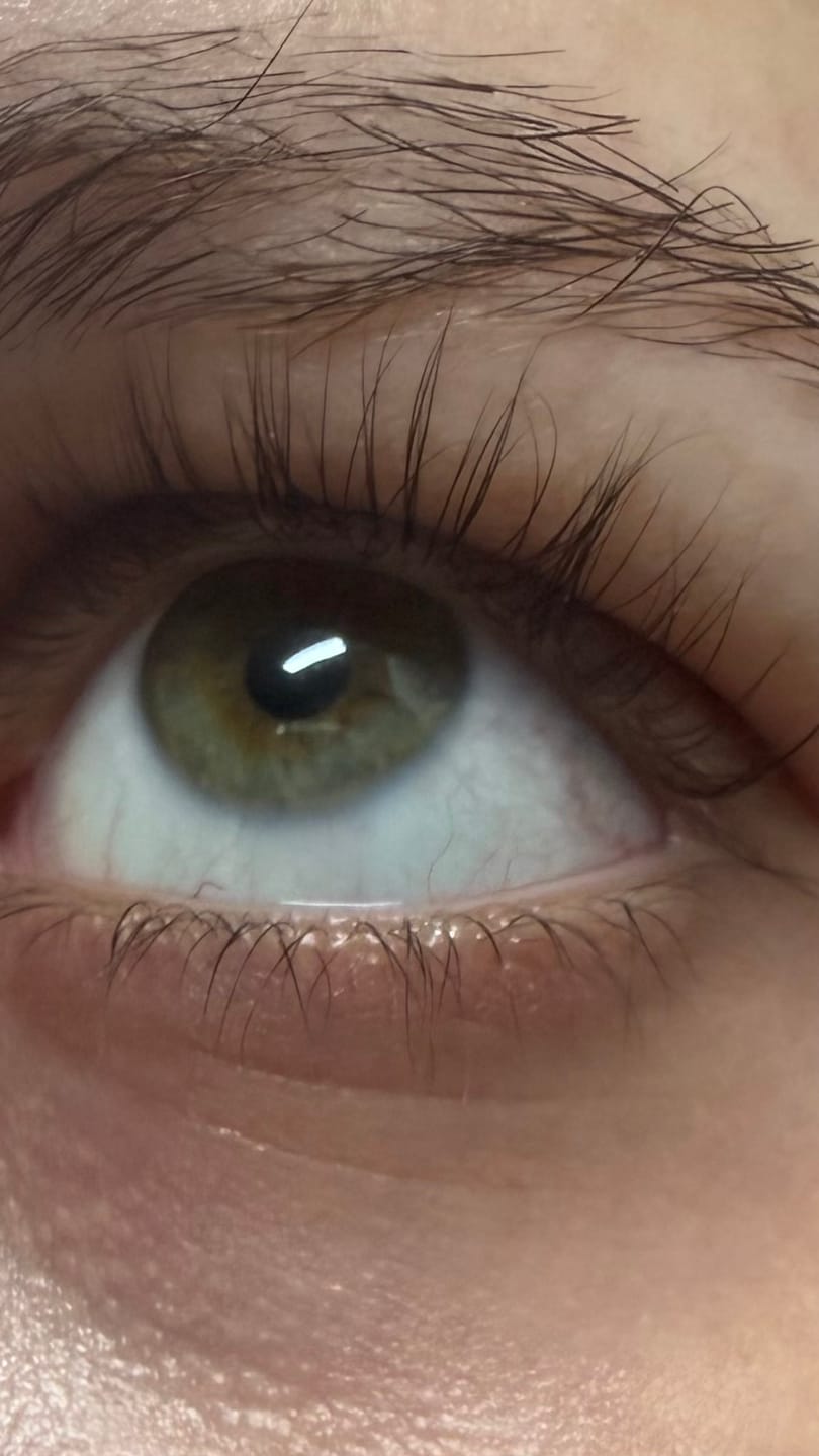 Customer photo review of LASHCOCA!NE - Wimpernserum