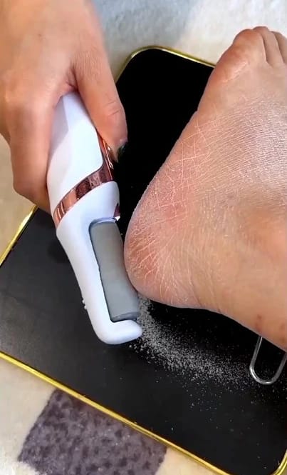 Customer photo review of SOVA Glide™