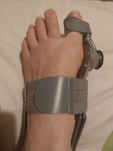 Customer's Treatmedy Bunion Fix on their foot, held in place by grey adjustable straps.
