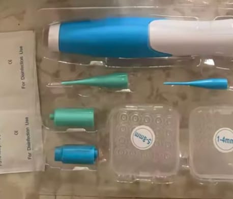Customer photo review of Schmerzfreies Stielwarzen-Entfernungsset