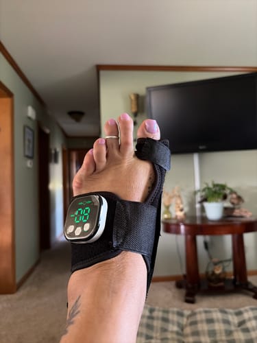 Customer's black Nexalign Pro EMS Bunion Corrector worn on foot, showing the digital screen display.