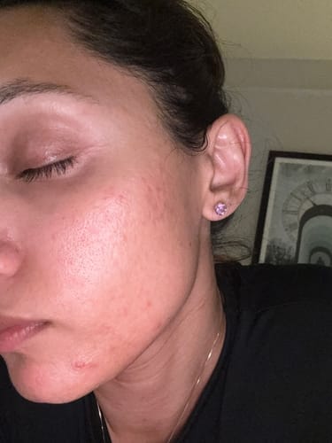Customer photo review of Skin Formula